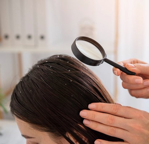 Anti-Dandruff-Treatment