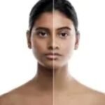 Brightening Treatment for Skin