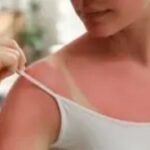 De Tan Treatments